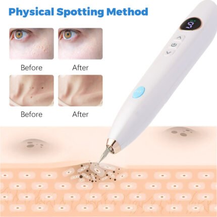 Safely and effectively remove skin tags and warts at home with our easy-to-use, portable Skin Tag Remover. Suitable for adults and individuals aged 12+, it features adjustable power settings and precision probes for quick, reliable results.