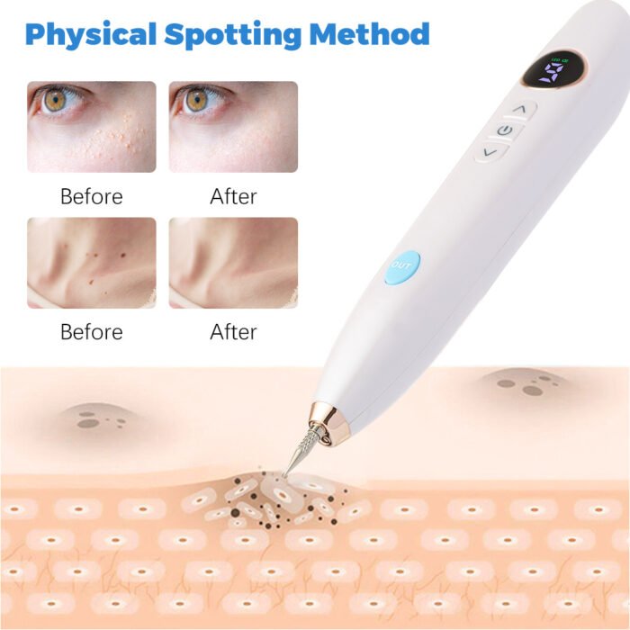Safely and effectively remove skin tags and warts at home with our easy-to-use, portable Skin Tag Remover. Suitable for adults and individuals aged 12+, it features adjustable power settings and precision probes for quick, reliable results.